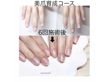 アモールネイル(amor nail)