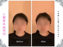 ボディ リセット アンド デザイン(Body Reset & Design)/【施術例】ビフォーアフター