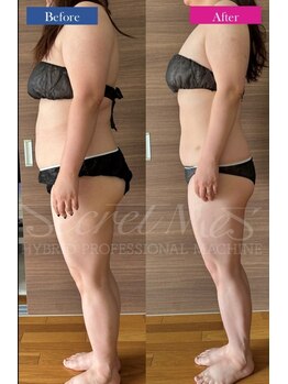 シャトン ボーテ(chaton beaute)/全身スリムに大変身!!