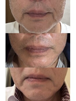 セレニテ(Serenite)/