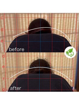 カイロプラクティック ネクサス/猫背と頭痛を撃退☆