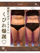 リンパケアサロン ジュビル(Jubil)