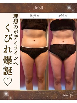リンパケアサロン ジュビル(Jubil)の写真/【くびれ革命】その脂肪、プロが本気で削ぎ落とします◆お腹周り集中ダイエット《110分¥9990》
