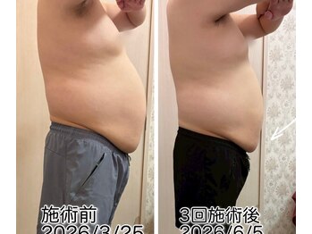 クールスパ(COOL SPA)/20代男性