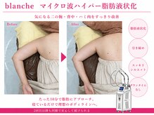 オリエンタルローザ 表参道(Oriental Rosa)/マイクロ波ハイパー脂肪液化術！