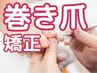 【歩くたびに痛い巻き爪をケア】初回カウンセリング×巻き爪矯正◎