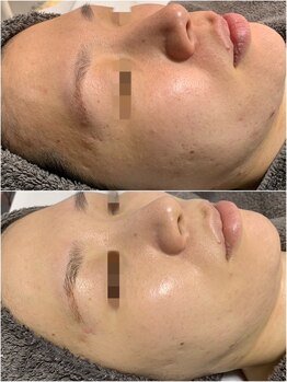 クレール(CLAIR)/30代のお客様