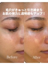 エリス(ELISSE)/チェンジマスクの効果