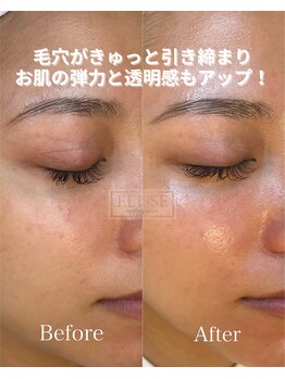 エリス(ELISSE)/チェンジマスクの効果