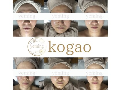 エミング(yeming)の写真