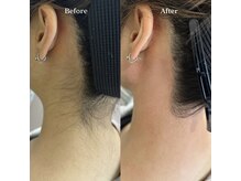 ホワイトワックス 浜松(WHITE WAX)/後ろ姿で差がつくうなじ