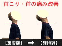 パルマ なかもず(Palma)/整体/頭痛/肩こり/ヘッドスパ