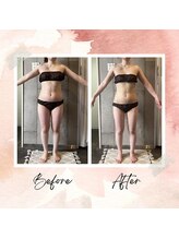パーソナルデトックスサロン エヌ(N)/ボディーラインも整うダイエット