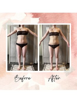 パーソナルデトックスサロン エヌ(N)/ボディーラインも整うダイエット
