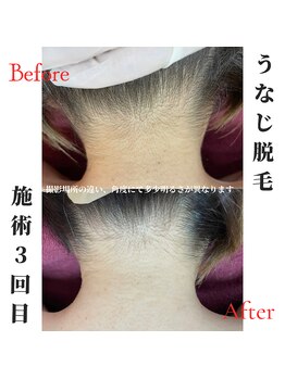 オリオンドットエスツー(Orion.S2)/【Before→After】