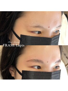 フレイズラピス(FRASE Lapis)/【ハリウッドブロウリフト】