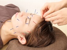 あかし整体院/【美容鍼かお鍼】