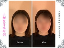 ボディ リセット アンド デザイン(Body Reset & Design)/【施術例】ビフォーアフター