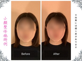 ボディ リセット アンド デザイン(Body Reset & Design)/【施術例】ビフォーアフター