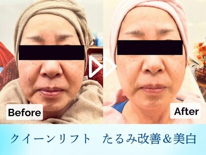 ブルービー(BLUE bee)の写真
