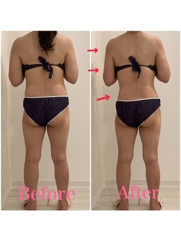 スペチアーレ 夙川/顔もボディもお悩み解決