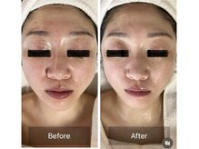 ミンク(Mink)の雰囲気（お悩みをしっかり聞き、１度でも変化を感じる施術をご提供◎）