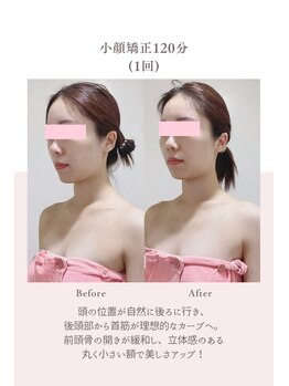 トゥインクル 麻布(twinkle)/港区/南麻布/白金高輪/小顔矯正