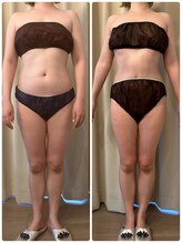 フォルスボーテ(Force Beaute)/お腹に脂肪分解♪