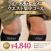 ラディアンス