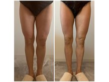 サロン ド ミース(salon de Mys)の雰囲気（シニアの方でも結果を出せるサロンです。）