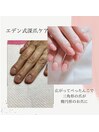究極の深爪ケア