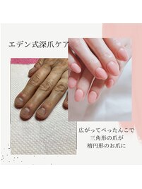 究極の深爪ケア