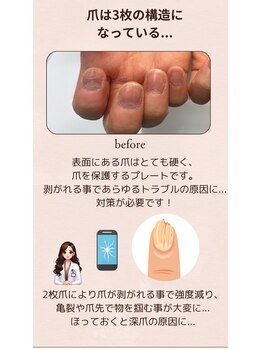 ヒューマン鍼灸接骨院/爪整体で美しさ健康を手に入れる