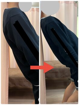 しもえのお整骨院/部活で腰が痛くなった！