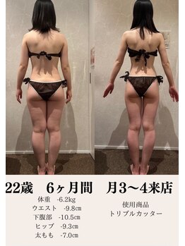 ポノ 甲府本店(pono)/筋膜リリース