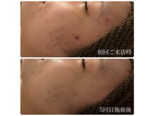 ブリエ(Briller)の雰囲気（続けた人だけが実感できる本当の効果）