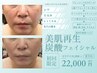 〈同窓会で振り返られる美肌づくり〉初エステ歓迎◎50代から初める美肌習慣