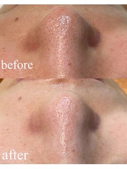 ファミーユ 太田(Fameu)/ハイドロスプラッシュ