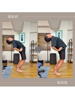 バレルメディカル研究所 恵比寿/腰痛の代償動作。