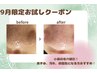 【小鼻毛穴洗浄】毛穴・黒ずみ、角質ケア！¥5,500→¥1,980