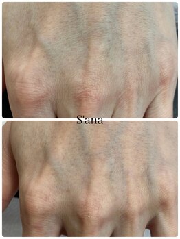 サナ 久が原 千鳥町(S’ana)/ルビッシュ照射