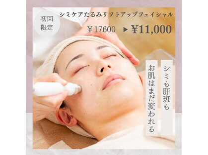 ルテラ(Lutella)の写真