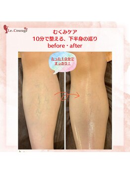 ル クラージュ(Le..Courage)/足のむくみの放置は危険！