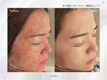 ベル 新橋(Belle)