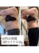 さとう美容整体 川崎本店/60代女性、5回でマイナス3kg