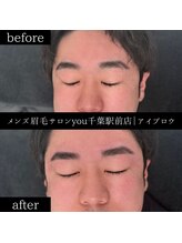 ユー 千葉駅前店(you)/ビフォ－アフター写真