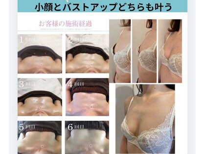 アール(R)の写真