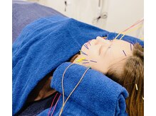 プロムナード(PROMENADE)/生肌美容鍼