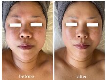 ディアンヌ(Diane)/小顔/骨盤/猫背/ゆがみ/二重あご