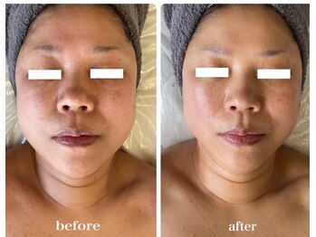 ディアンヌ(Diane)/小顔/骨盤/猫背/ゆがみ/二重あご